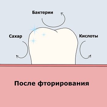 После фторирования зубов - воздействие вредных факторов