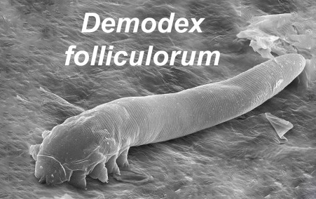 Клещ Демодекс (Demodex folliculorum) под сканирующим электронным микроскопом