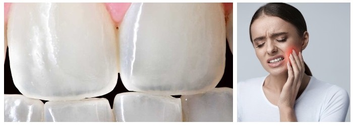 chuvstvitelnye zuby emal1