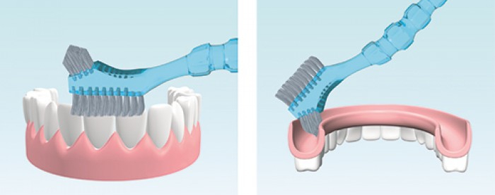 Гигиена полости рта и бюгельных зубных протезов