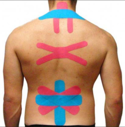 Тейпирование спины при болях, поясницы, грудного отдела, шеи, улучшение осанки