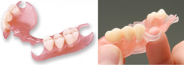 Варианты гибких бюгельных зубных протезов