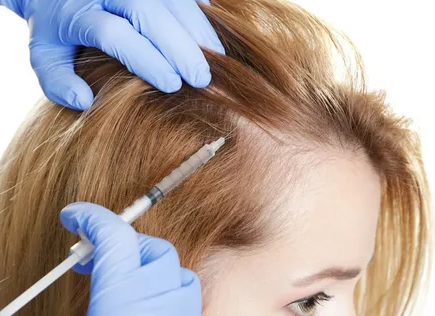 Мезотерапия для роста и улучшения структуры волос